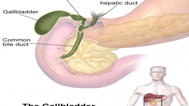 Safra Kesesi Ameliyatı Nedir?