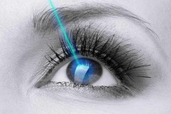 Lasik Lazer