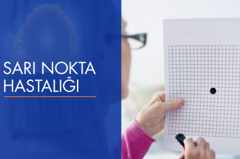 Sarı Nokta Tedavisi